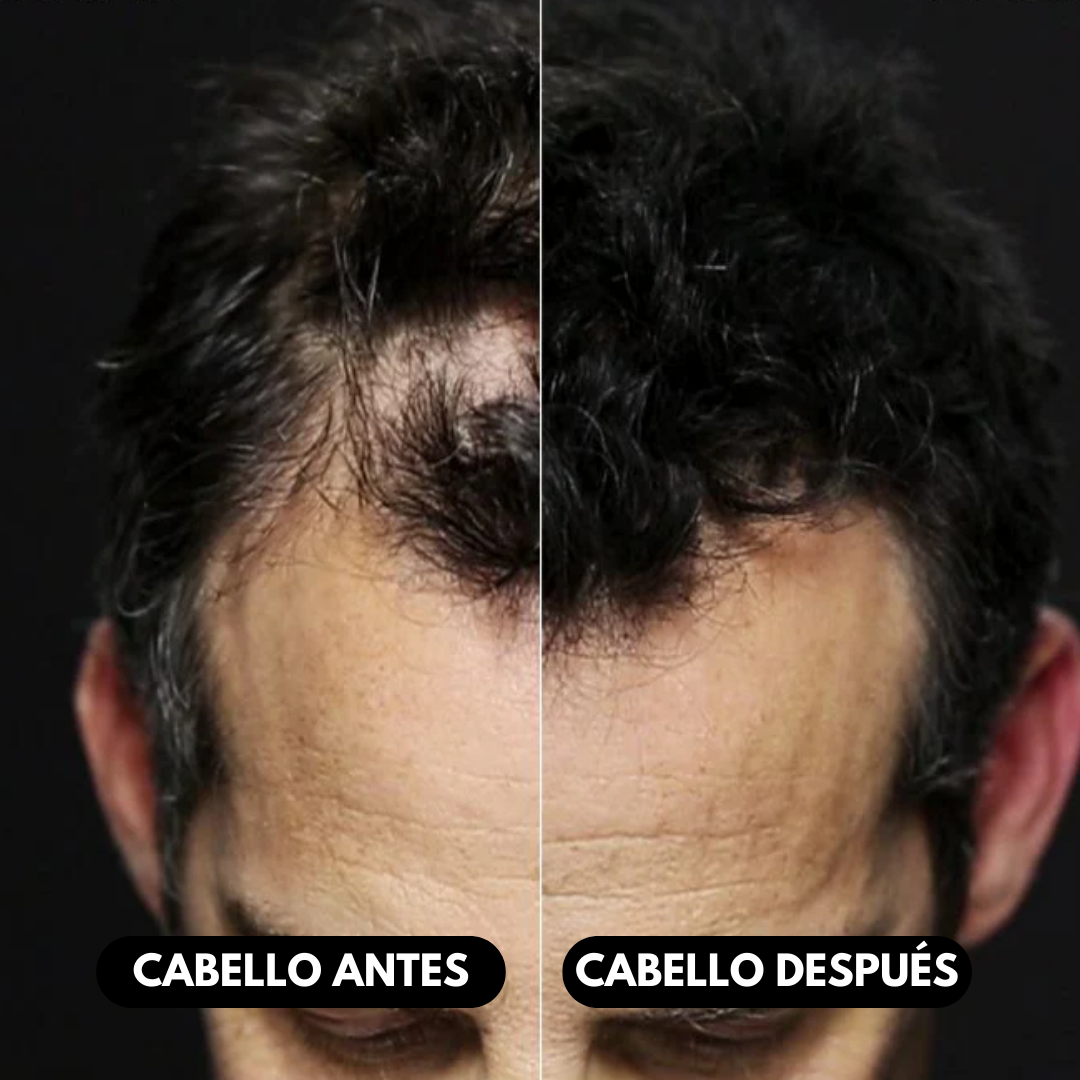 Fibras Capilares Toppik 27.5 Grs