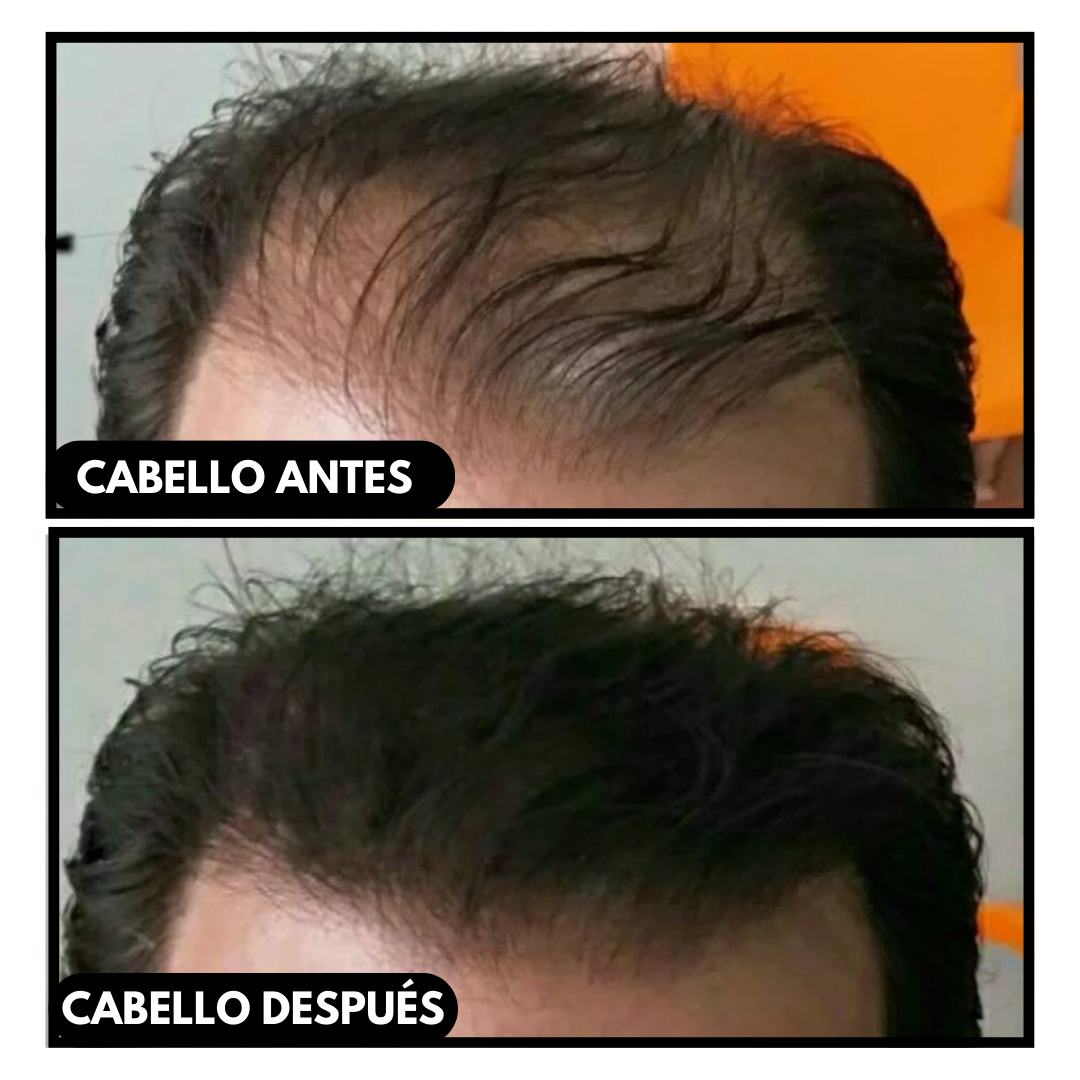 Fibras Capilares 27.5g Queratina + Aplicador De Precisión