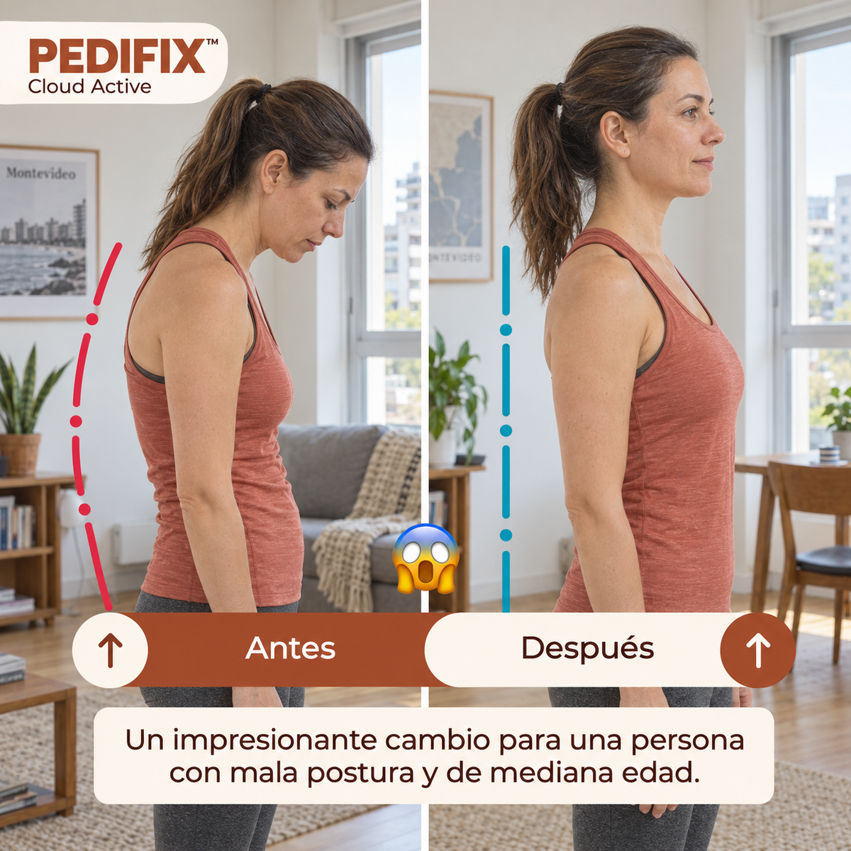 Comparación gráfica de postura antes y después con estética Pedifix