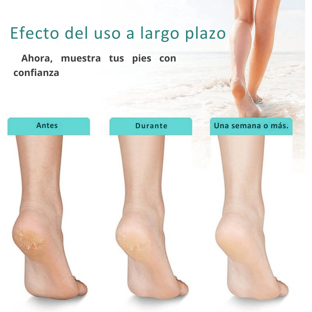 Removedor de Callos de Cristal Nano - Muy Moderna Uruguay