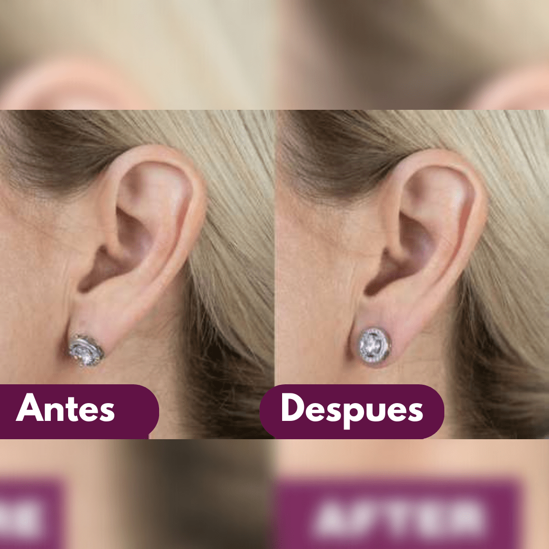 Correctores de Orejas Para Caravanas (2 Pares) - Muy Moderna Uruguay