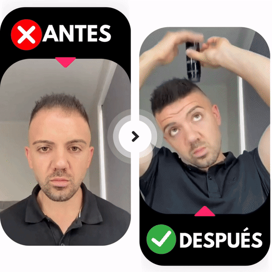 Fibras Capilares 27.5g Queratina + Aplicador De Precisión