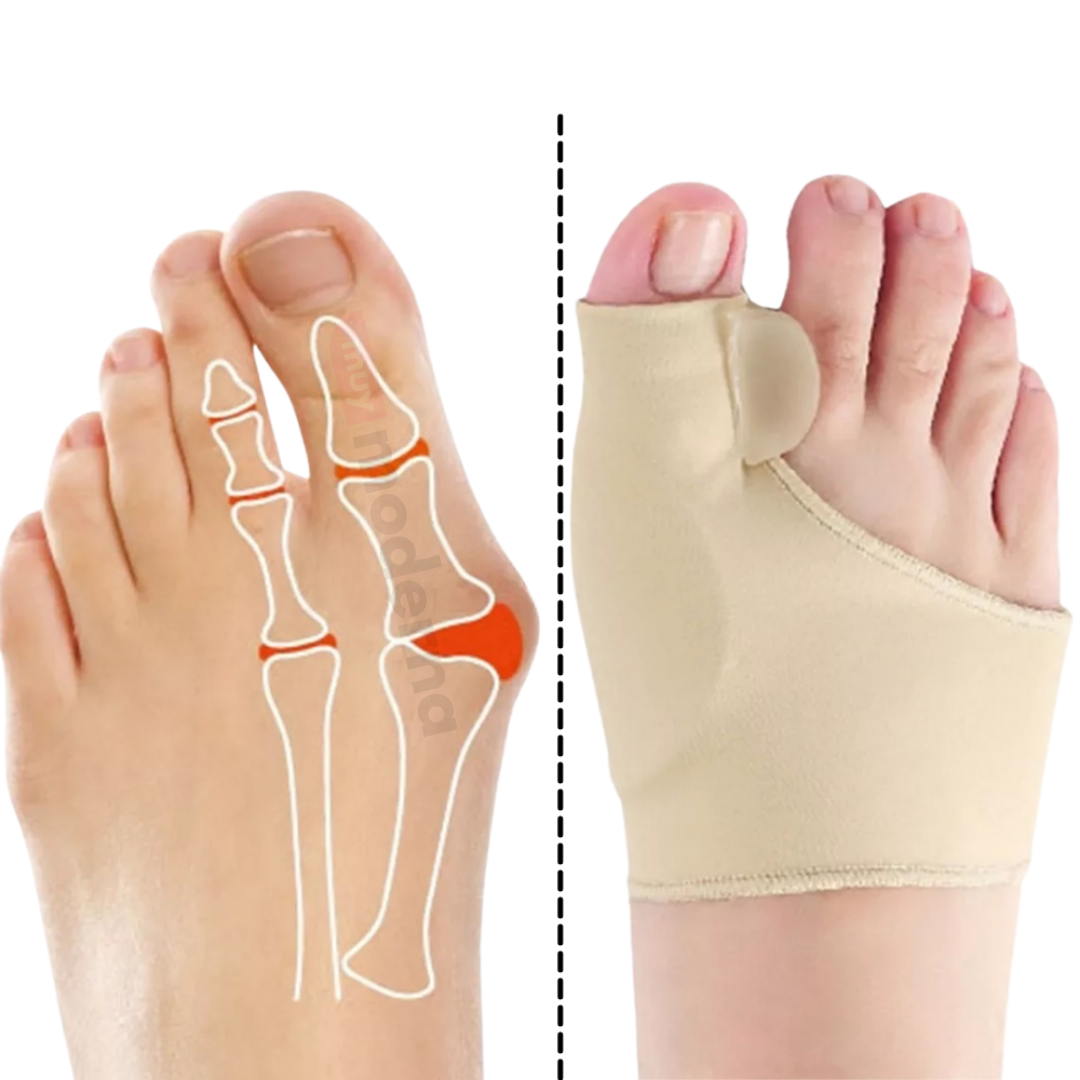 Correctores de Juanetes con Separadores de Dedo