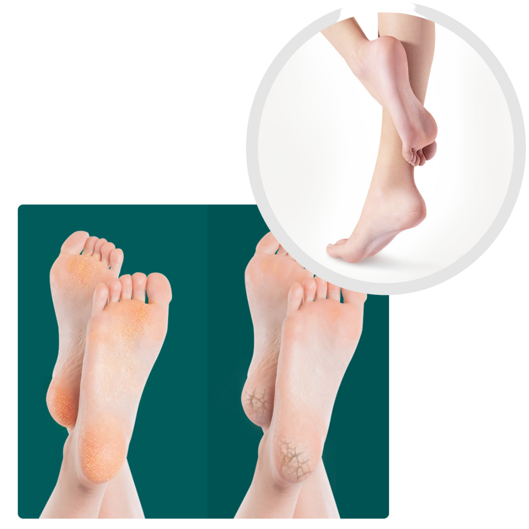 Lima de Pedicura para Eliminar Callos y Piel Muerta