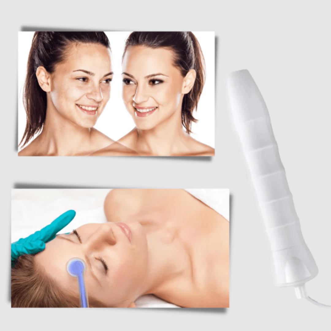FaceTone Dispositivo de Alta Frecuencia Facial - Muy Moderna Uruguay