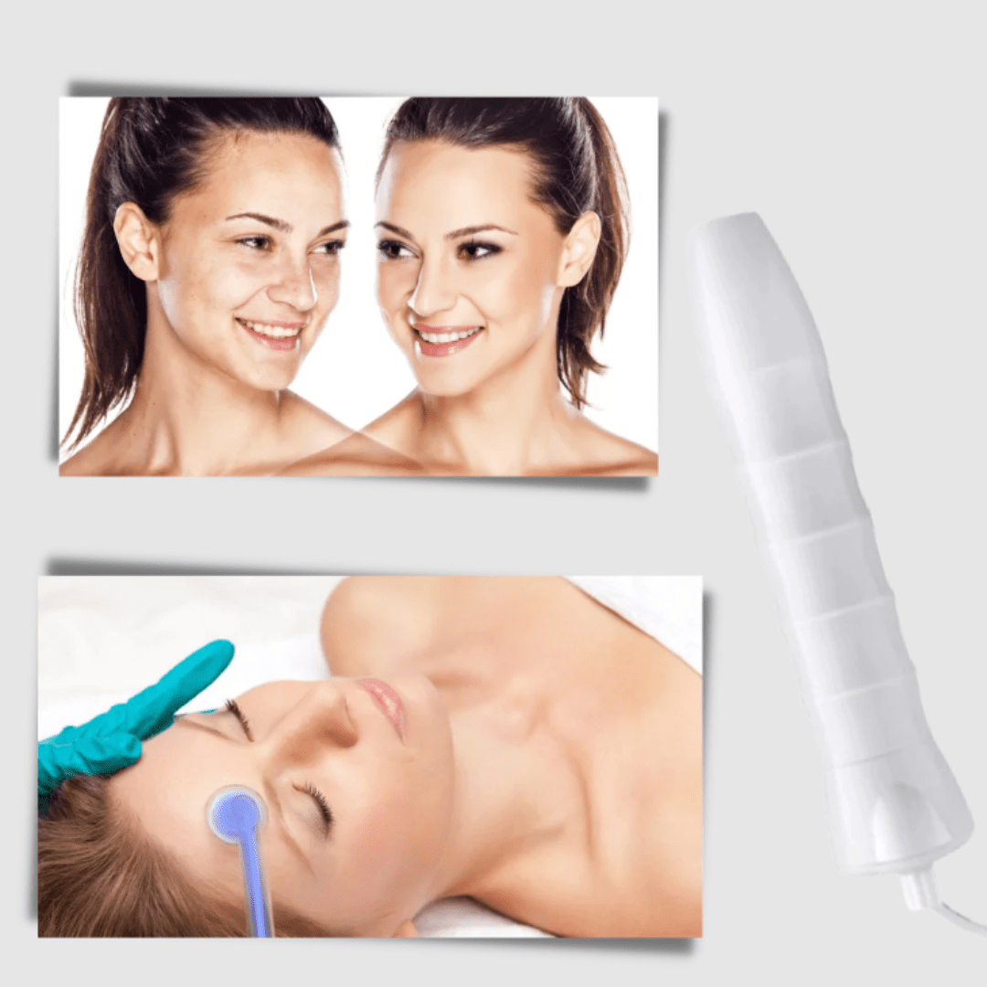 FaceTone Dispositivo de Alta Frecuencia Facial - Muy Moderna Uruguay