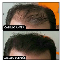 Fibras Capilares Toppik 27.5 Grs