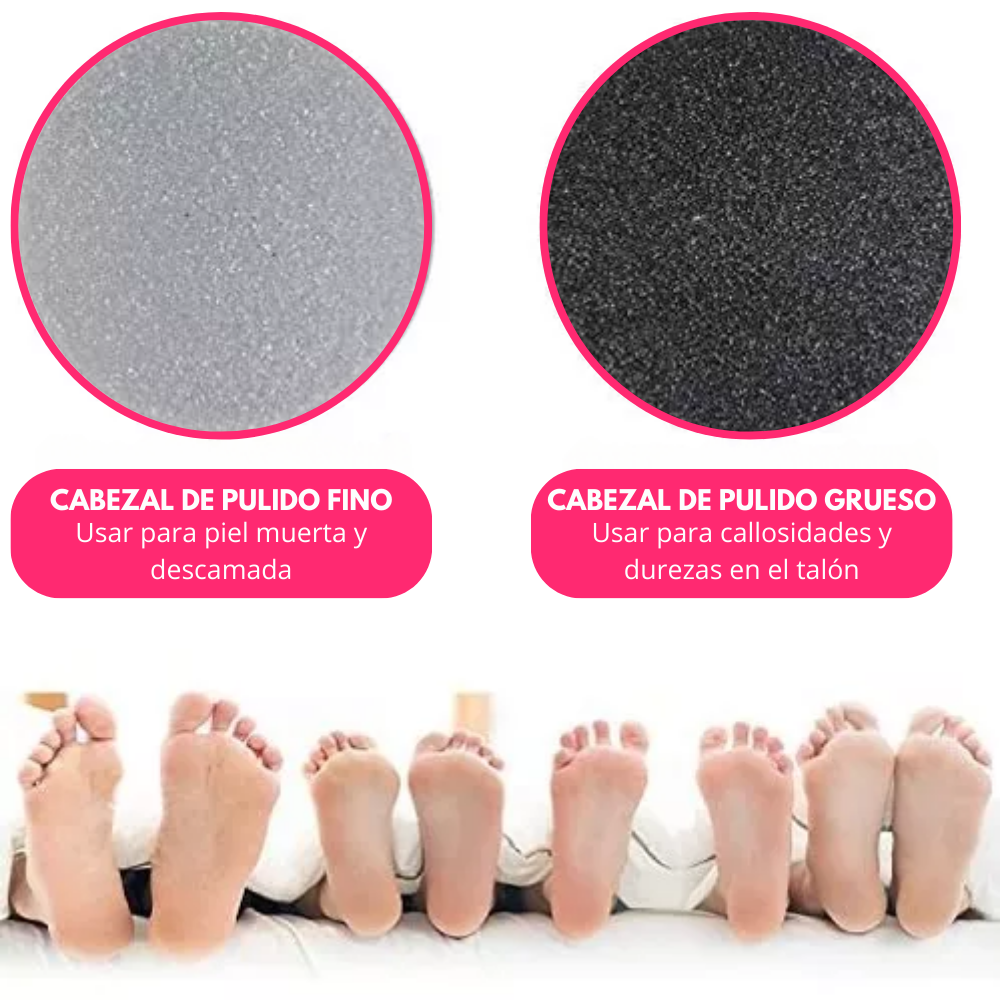 Pack de Repuestos para Removedor de callos Pedi Vac