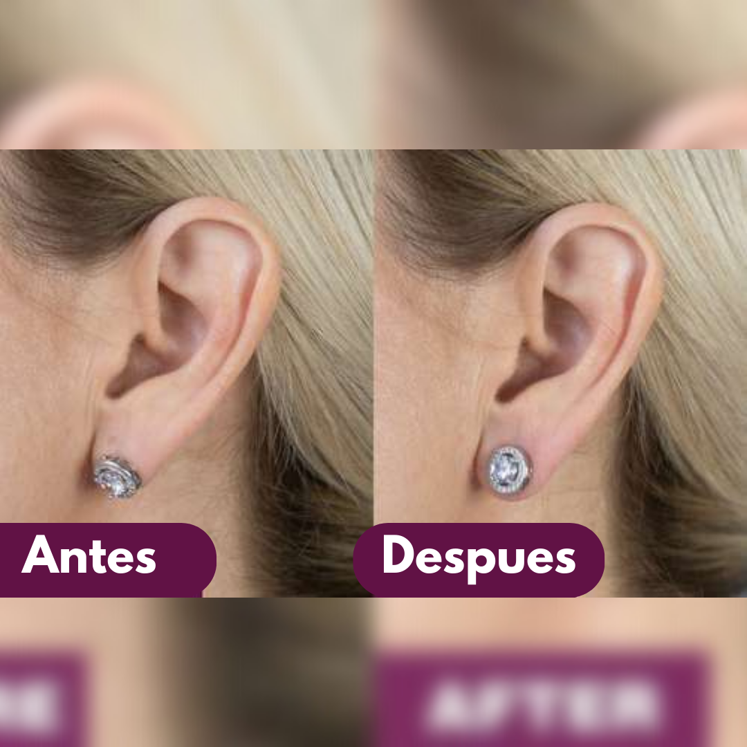 Correctores de Orejas Para Caravanas (2 Pares)