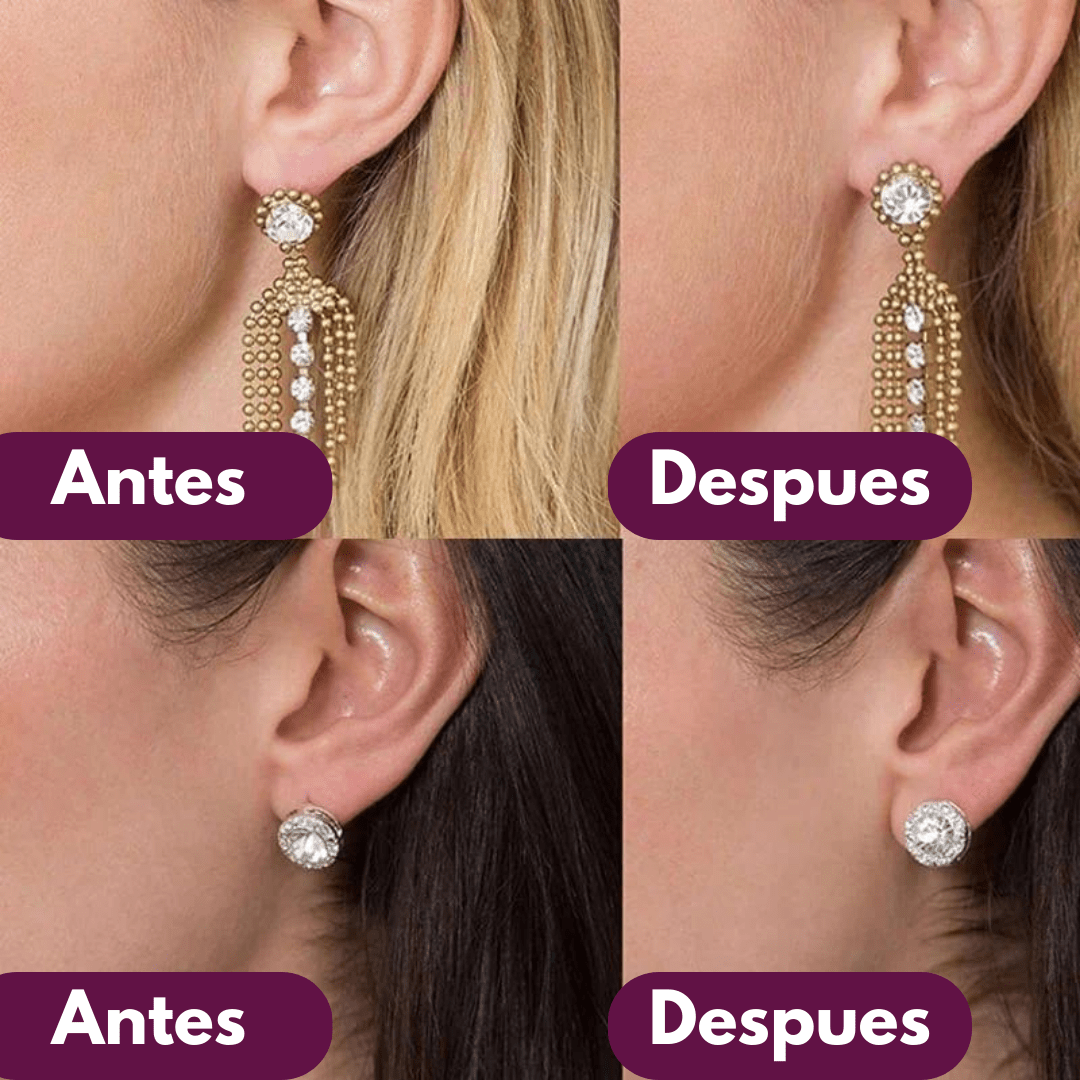 Correctores de Orejas Para Caravanas (2 Pares) - Muy Moderna Uruguay