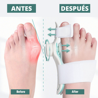 Corrector de Juanetes Graduable Con Perilla y Gel Fresco (1 Unidad)